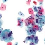 Servikal Smear Testi
