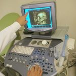 4 Boyutlu Ultrason Nedir?